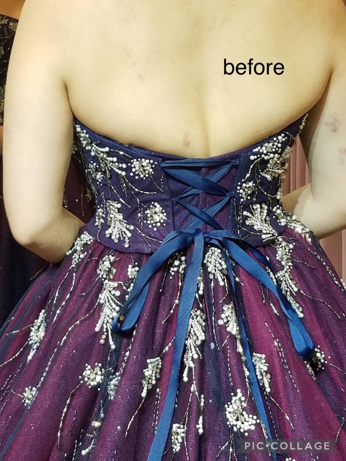 S様の施術前の写真